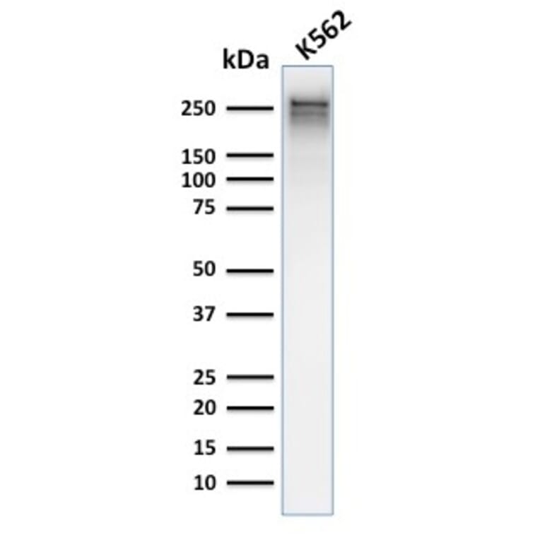 Western Blot - Anti-alpha 1 Spectrin Antibody [rSPTA1/1832] (A250038) - Antibodies.com