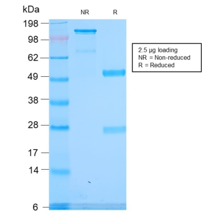 SDS-PAGE - Anti-alpha 1 Spectrin Antibody [SPTA1/2939R] (A250039) - Antibodies.com