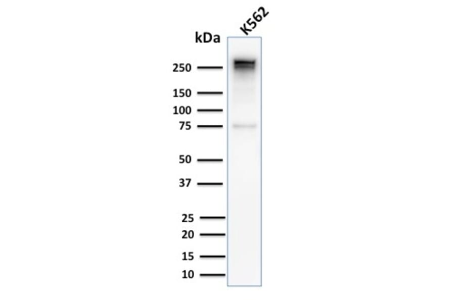 Western Blot - Anti-alpha 1 Spectrin Antibody [SPTA1/2939R] (A250039) - Antibodies.com