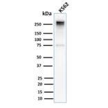Western Blot - Anti-alpha 1 Spectrin Antibody [SPTA1/2939R] (A250039) - Antibodies.com