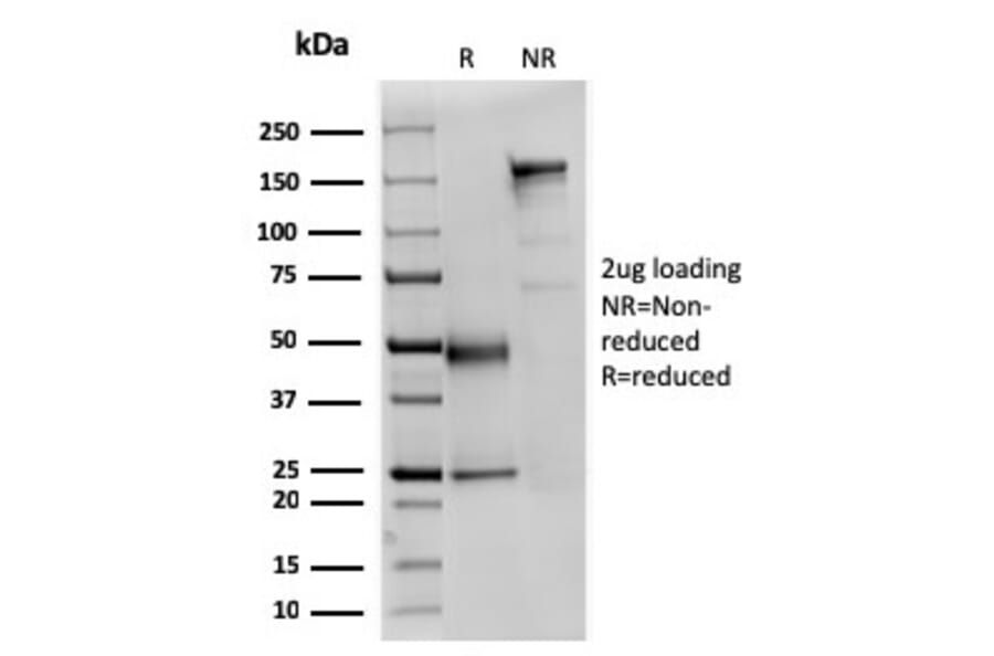 SDS-PAGE - Anti-alpha Fodrin Antibody [SPTAN1/3351] (A250040) - Antibodies.com
