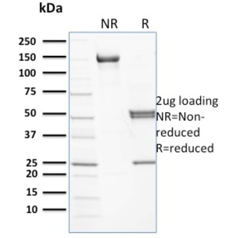SDS-PAGE - Anti-beta III Spectrin Antibody [RG/26] (A250041) - Antibodies.com