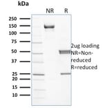 SDS-PAGE - Anti-beta III Spectrin Antibody [RG/26] (A250041) - Antibodies.com