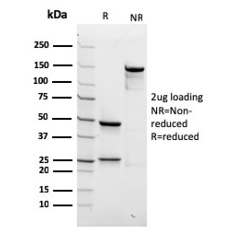 SDS-PAGE - Anti-beta III Spectrin Antibody [rSPTBN2/1778] (A250043) - Antibodies.com