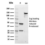 SDS-PAGE - Anti-beta III Spectrin Antibody [rSPTBN2/1778] (A250043) - Antibodies.com