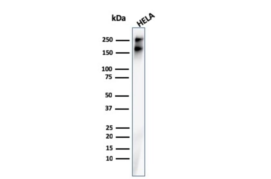 Western Blot - Anti-beta III Spectrin Antibody [rSPTBN2/1778] (A250043) - Antibodies.com
