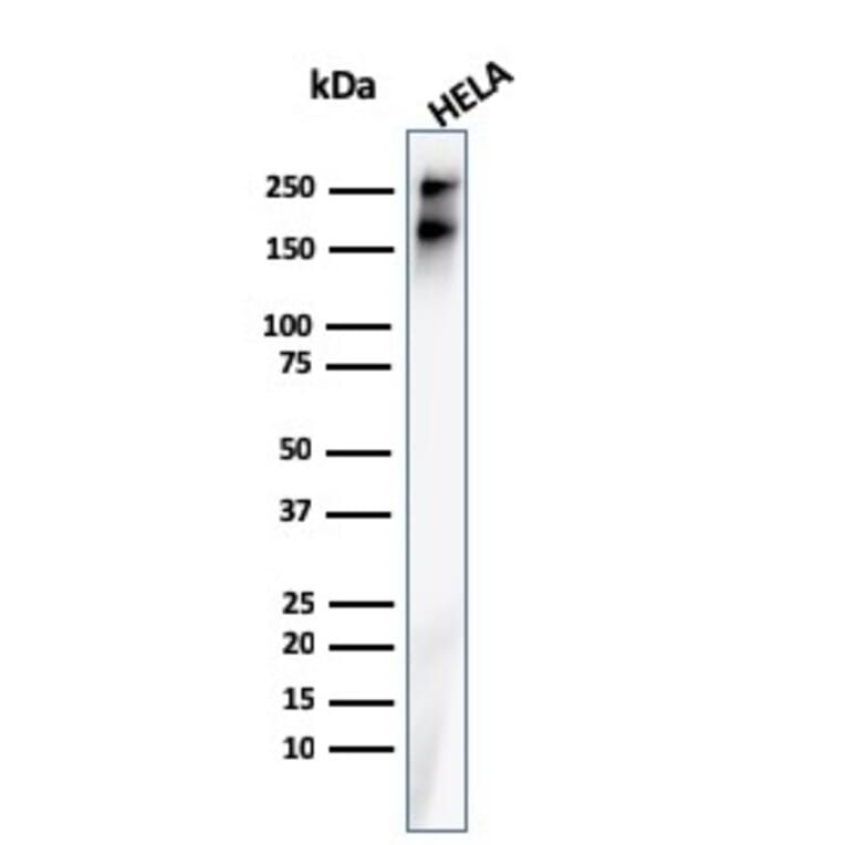 Western Blot - Anti-beta III Spectrin Antibody [rSPTBN2/1778] (A250043) - Antibodies.com