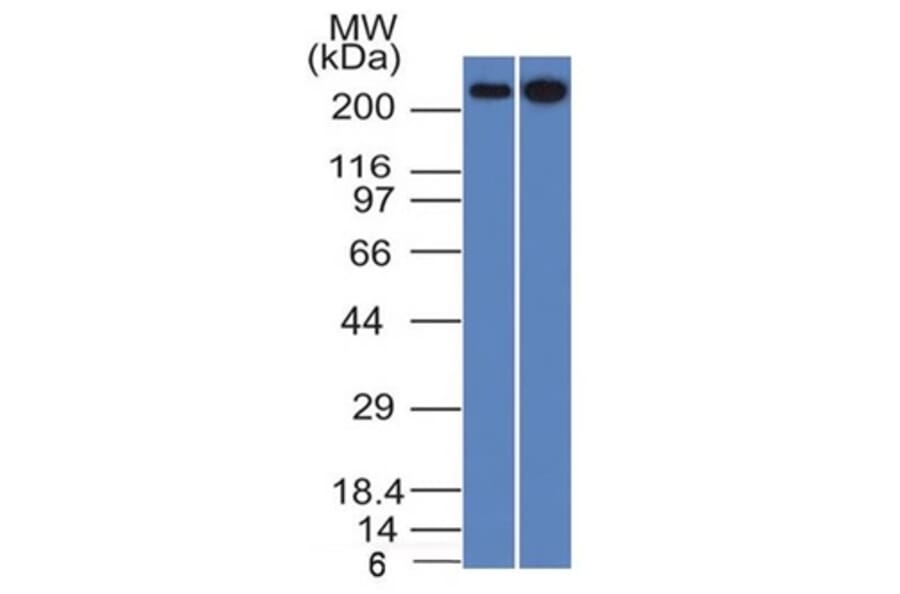 Western Blot - Anti-beta III Spectrin Antibody [SPTBN2/1582] (A250044) - Antibodies.com