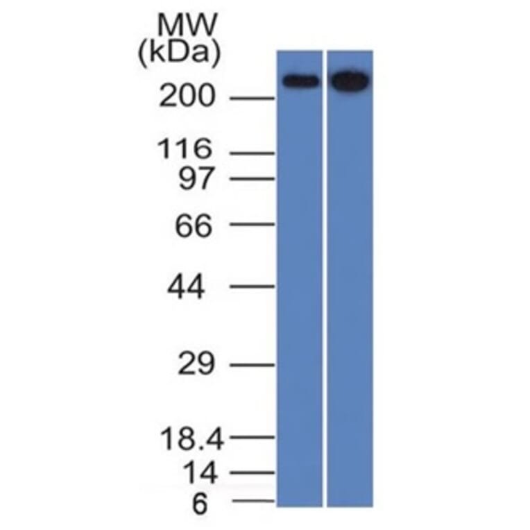 Western Blot - Anti-beta III Spectrin Antibody [SPTBN2/1582] (A250044) - Antibodies.com