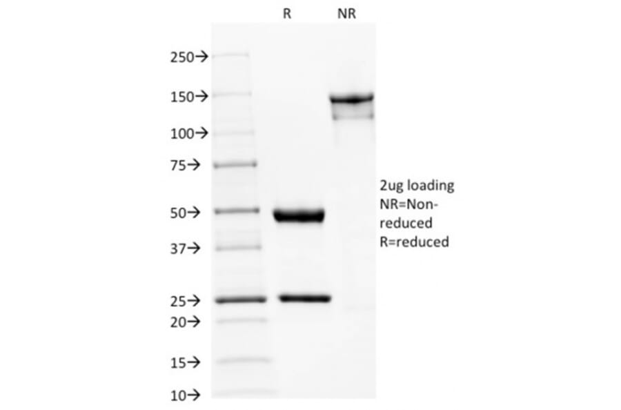 SDS-PAGE - Anti-beta III Spectrin Antibody [SPTBN2/1582] (A250044) - Antibodies.com