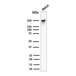 Western Blot - Anti-beta III Spectrin Antibody [SPTBN2/1582] (A250044) - Antibodies.com