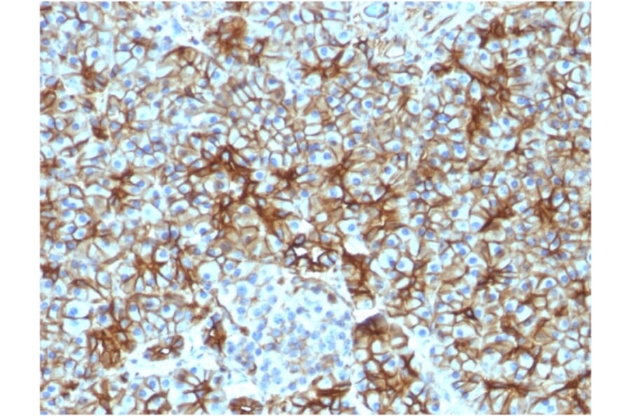 Immunohistochemistry - Anti-beta III Spectrin Antibody [SPTBN2/1583] (A250045) - Antibodies.com