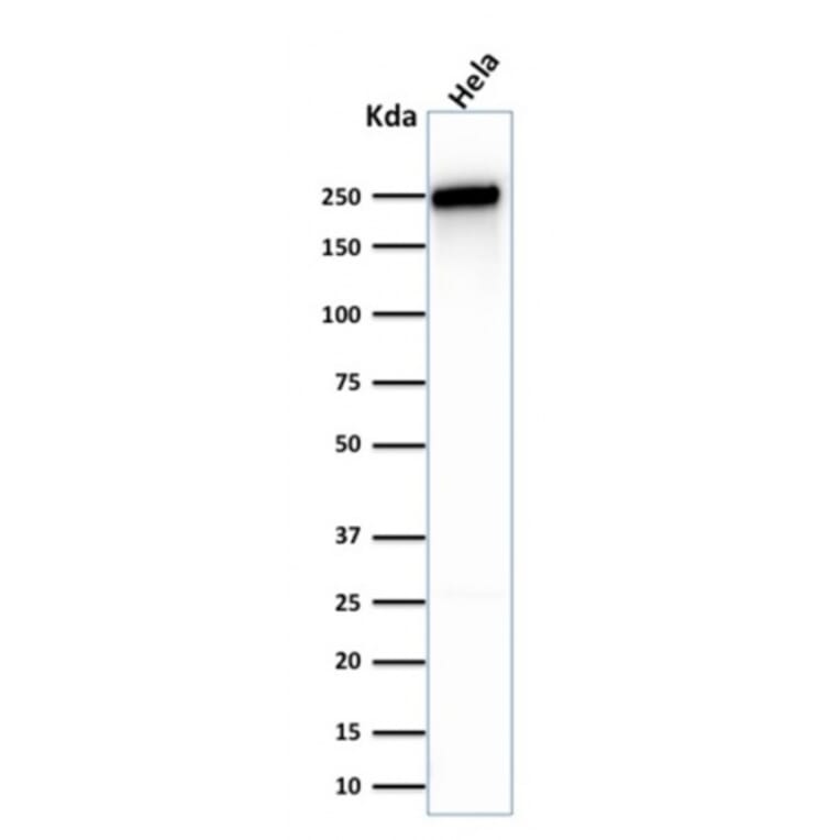 Western Blot - Anti-beta III Spectrin Antibody [SPTBN2/1583] (A250045) - Antibodies.com