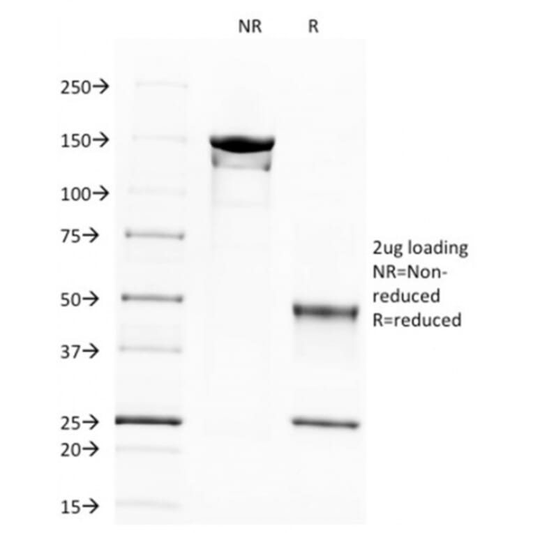 SDS-PAGE - Anti-beta III Spectrin Antibody [SPTBN2/1583] (A250045) - Antibodies.com