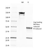 SDS-PAGE - Anti-beta III Spectrin Antibody [SPTBN2/1583] (A250045) - Antibodies.com