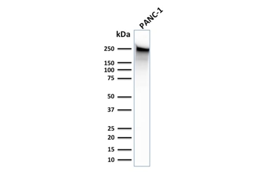 Western Blot - Anti-beta III Spectrin Antibody [SPTBN2/1583] (A250045) - Antibodies.com