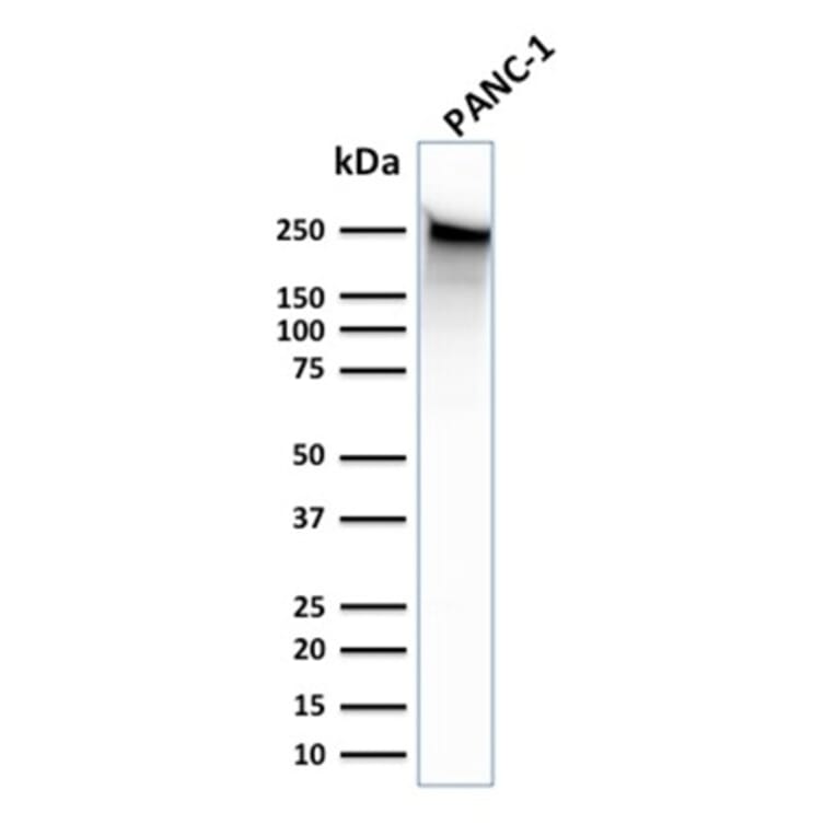 Western Blot - Anti-beta III Spectrin Antibody [SPTBN2/1583] (A250045) - Antibodies.com