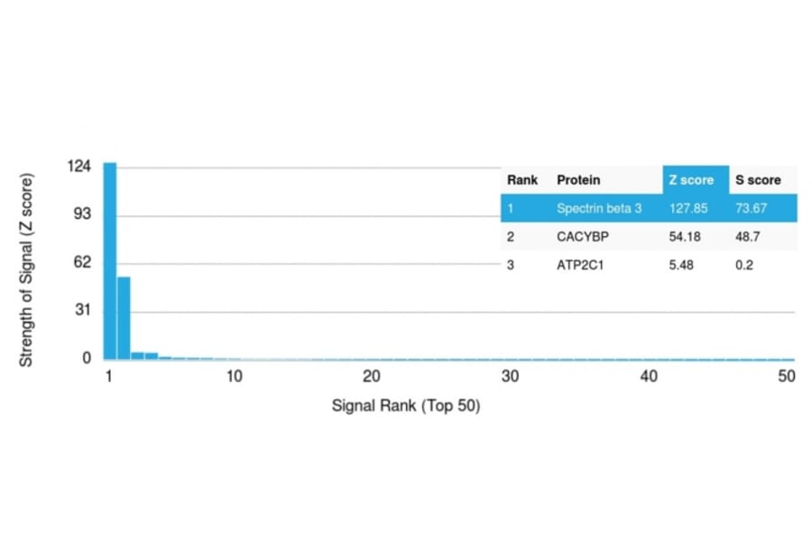 Protein Array - Anti-beta III Spectrin Antibody [SPTBN2/1583] (A250044) - Antibodies.com