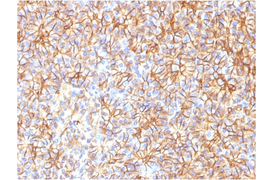 Immunohistochemistry - Anti-beta III Spectrin Antibody [SPTBN2/1584] (A250046) - Antibodies.com