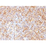 Immunohistochemistry - Anti-beta III Spectrin Antibody [SPTBN2/1584] (A250046) - Antibodies.com