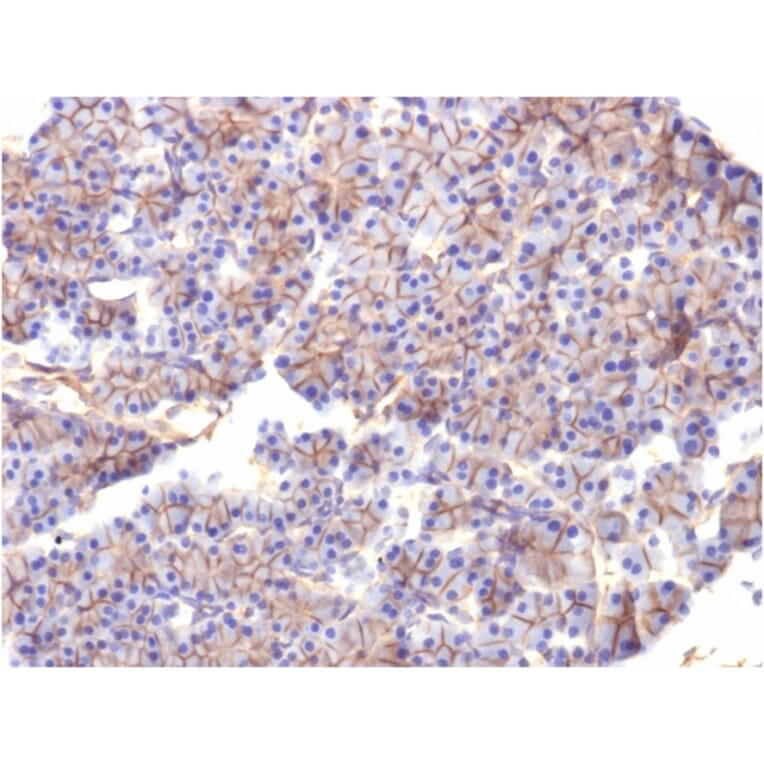 Immunohistochemistry - Anti-beta III Spectrin Antibody [SPTBN2/1584] (A250046) - Antibodies.com