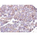 Immunohistochemistry - Anti-beta III Spectrin Antibody [SPTBN2/1584] (A250046) - Antibodies.com