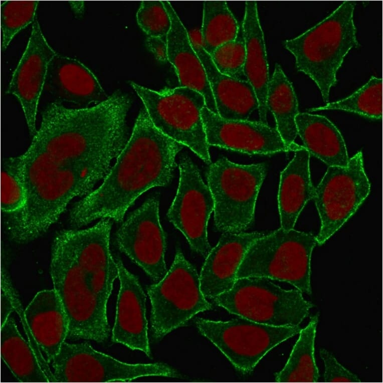 Immunofluorescence - Anti-beta III Spectrin Antibody [SPTBN2/1584] (A250046) - Antibodies.com