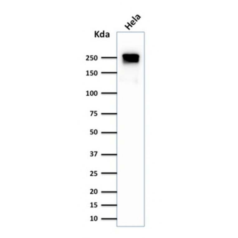 Western Blot - Anti-beta III Spectrin Antibody [SPTBN2/1584] (A250046) - Antibodies.com