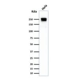 Western Blot - Anti-beta III Spectrin Antibody [SPTBN2/1584] (A250046) - Antibodies.com