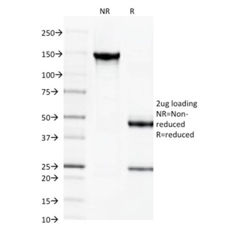 SDS-PAGE - Anti-beta III Spectrin Antibody [SPTBN2/1584] (A250046) - Antibodies.com