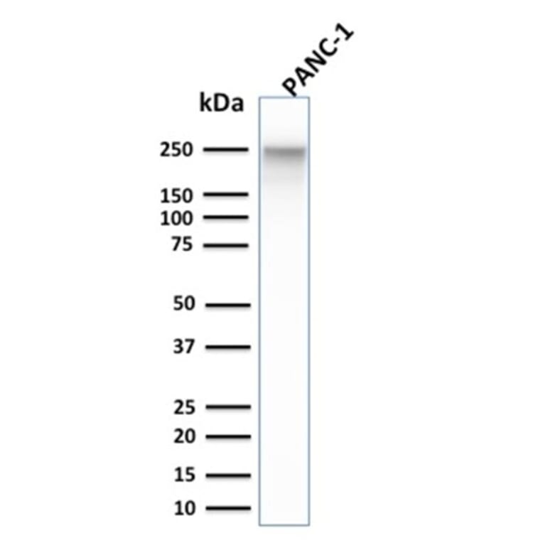 Western Blot - Anti-beta III Spectrin Antibody [SPTBN2/1584] (A250046) - Antibodies.com