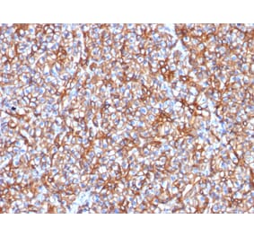 Immunohistochemistry - Anti-beta III Spectrin Antibody [SPTBN2/1778] (A250047) - Antibodies.com
