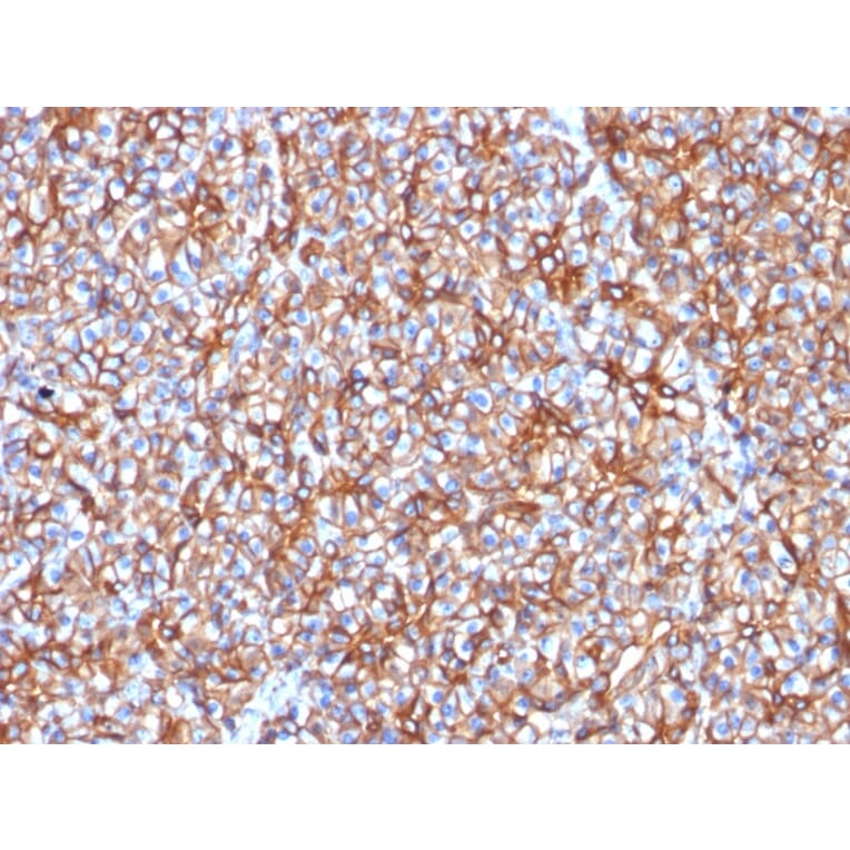 Immunohistochemistry - Anti-beta III Spectrin Antibody [SPTBN2/1778] (A250047) - Antibodies.com