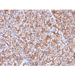 Immunohistochemistry - Anti-beta III Spectrin Antibody [SPTBN2/1778] (A250047) - Antibodies.com