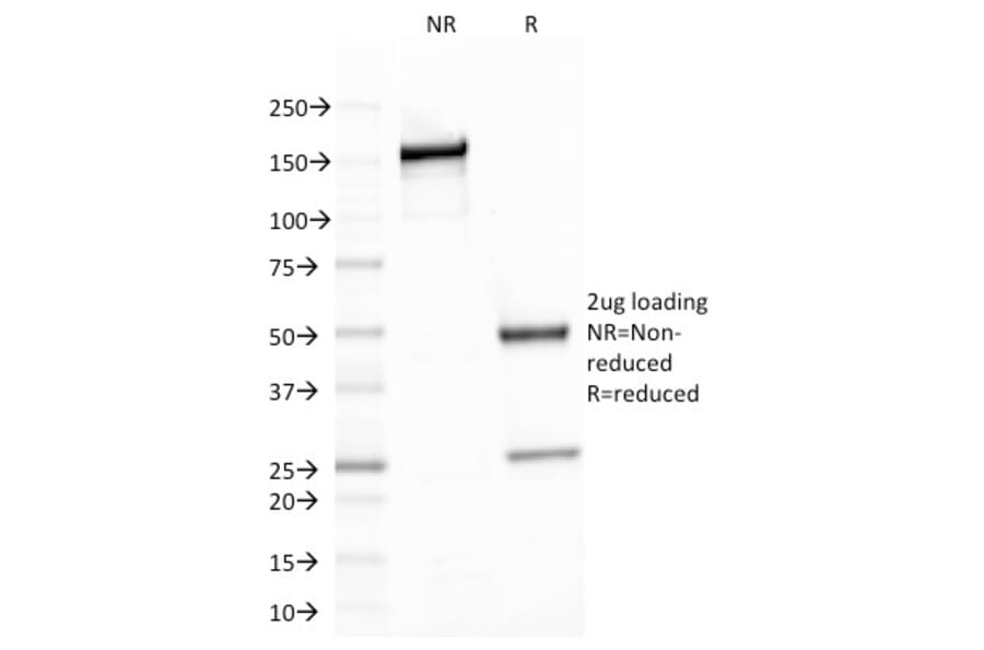 SDS-PAGE - Anti-beta III Spectrin Antibody [SPTBN2/1778] (A250047) - Antibodies.com