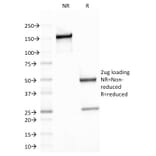 SDS-PAGE - Anti-beta III Spectrin Antibody [SPTBN2/1778] (A250047) - Antibodies.com