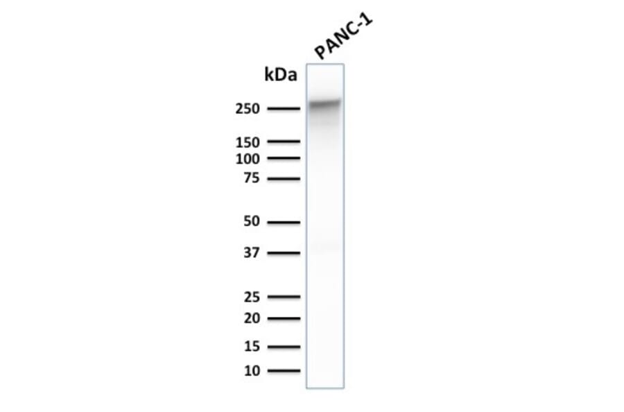 Western Blot - Anti-beta III Spectrin Antibody [SPTBN2/1778] (A250047) - Antibodies.com
