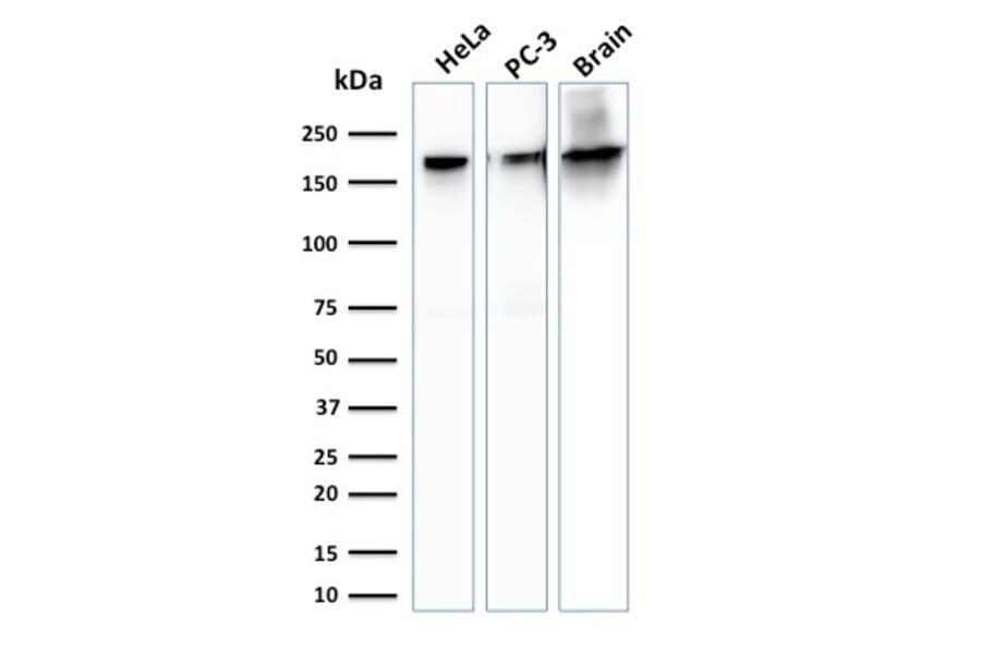 Western Blot - Anti-beta III Spectrin Antibody [SPTBN2/1778] (A250047) - Antibodies.com
