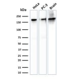 Western Blot - Anti-beta III Spectrin Antibody [SPTBN2/1778] (A250047) - Antibodies.com