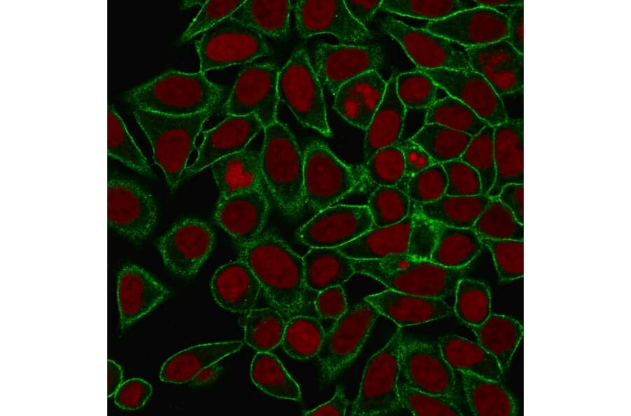 Immunofluorescence - Anti-beta III Spectrin Antibody [SPTBN2/1778] (A250047) - Antibodies.com