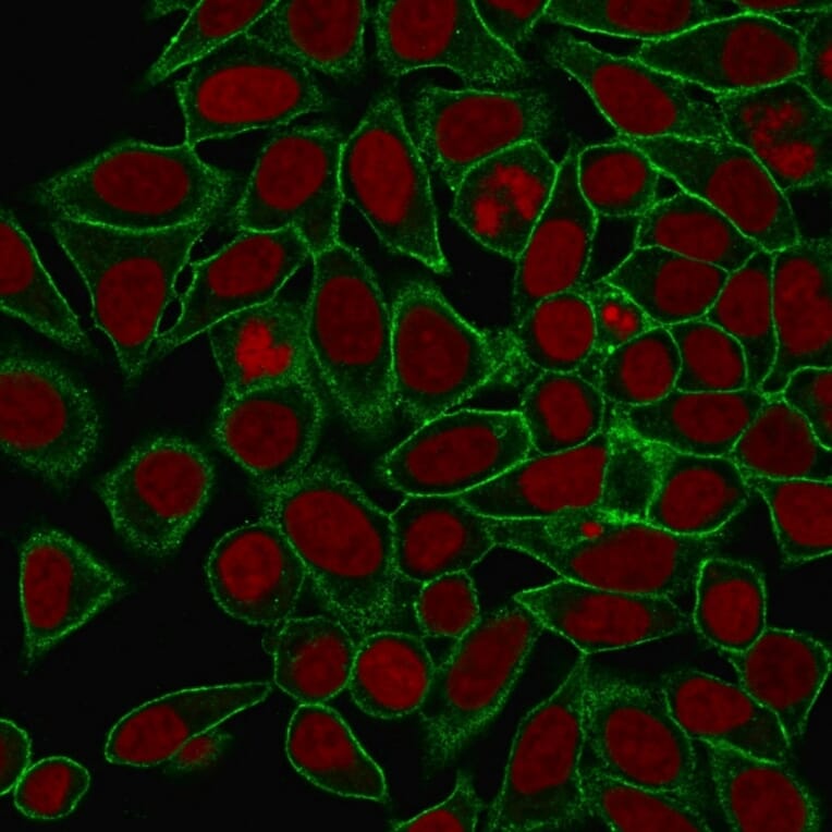 Immunofluorescence - Anti-beta III Spectrin Antibody [SPTBN2/1778] (A250047) - Antibodies.com