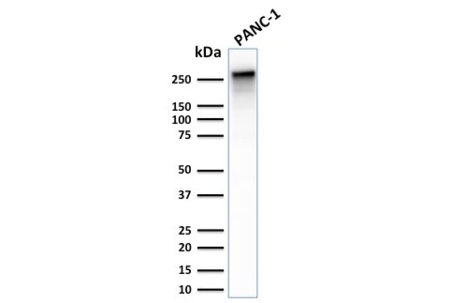 Western Blot - Anti-beta III Spectrin Antibody [SPTBN2/2887R] (A250048) - Antibodies.com