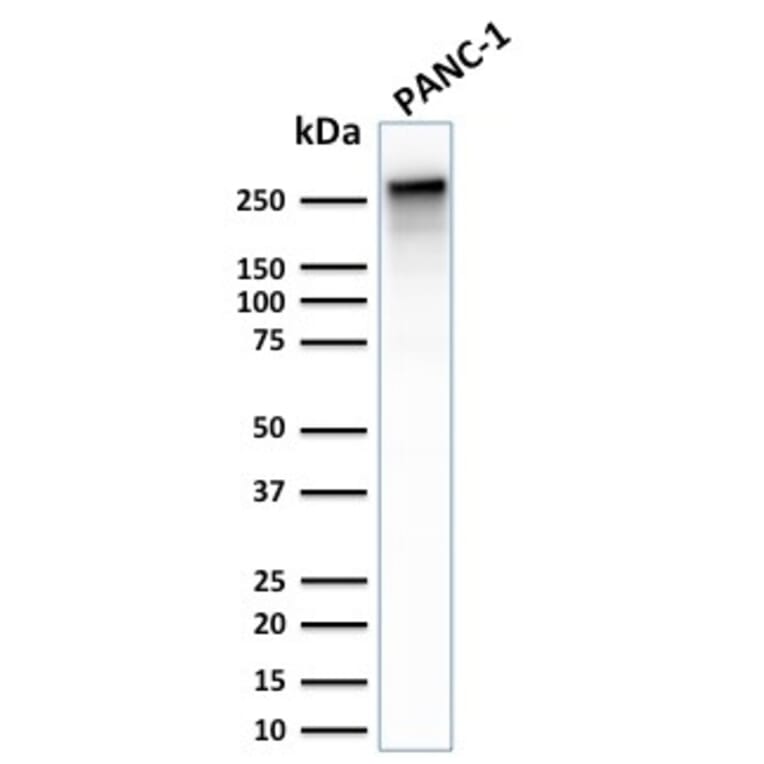 Western Blot - Anti-beta III Spectrin Antibody [SPTBN2/2887R] (A250048) - Antibodies.com