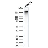 Western Blot - Anti-beta III Spectrin Antibody [SPTBN2/2887R] (A250048) - Antibodies.com