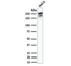 Western Blot - Anti-beta III Spectrin Antibody [SPTBN2/2894R] (A250049) - Antibodies.com