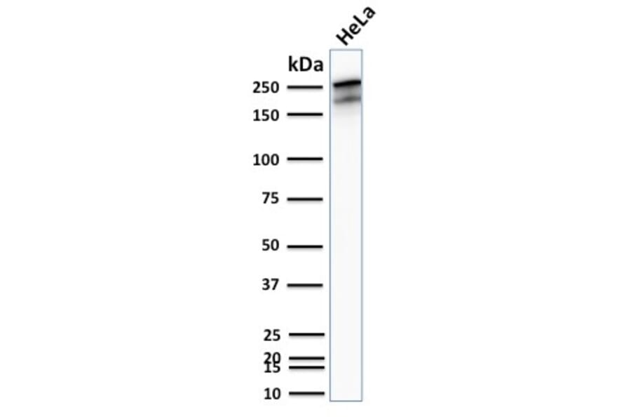 Western Blot - Anti-beta III Spectrin Antibody [SPTBN2/2894R] (A250049) - Antibodies.com