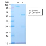 SDS-PAGE - Anti-beta III Spectrin Antibody [SPTBN2/2894R] (A250049) - Antibodies.com