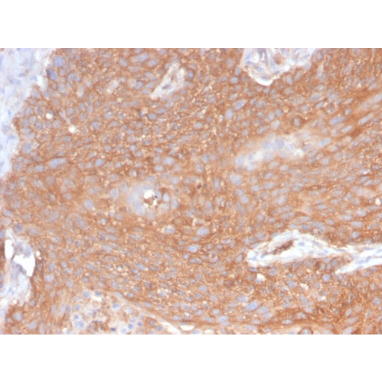 Immunohistochemistry - Anti-beta III Spectrin Antibody [SPTBN2/2894R] (A250049) - Antibodies.com