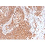 Immunohistochemistry - Anti-beta III Spectrin Antibody [SPTBN2/2894R] (A250049) - Antibodies.com