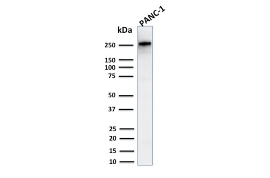 Western Blot - Anti-beta III Spectrin Antibody [SPTBN2/2894R] (A250049) - Antibodies.com